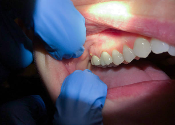 Best Pediatric Emergency Dentist in Upper Arlington, OH